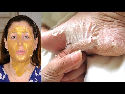 Le malattie di occhi hanno gonfiato una palpebra superiore Affronti pacchi dopo di 40 anni dal cosmetologo
