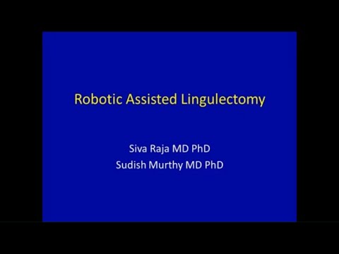 Robotic Lingulectomy For Lung Mass