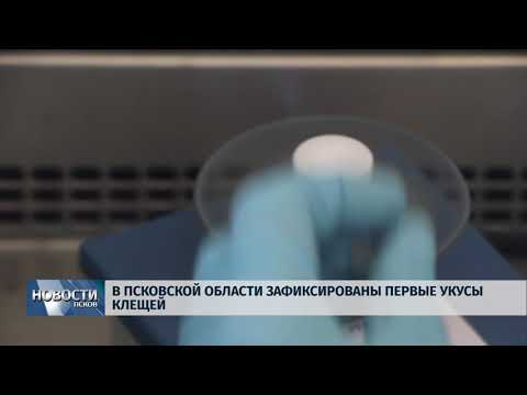 12.04.2018 # В Псковской области зафиксированы первые укусы клещей