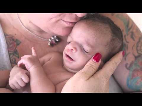 Adoptive mom flees in tears upon seeing newborns birth defects biological mom decides to keep her li