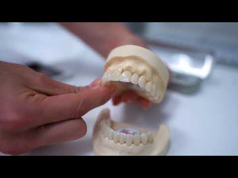 Zahnersatz an einem Tag - Dr. Dr. Thea Lingohr MSc.