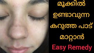 മൂക്കിന്റെ മുകളിലുണ്ടാവുന്ന കറുത്ത വര മാറ്റം || How to remove dark line on nose naturally at home