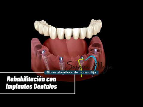 video RV2erqeYsFU