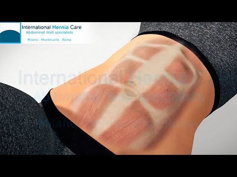 Gonfio grande joint punta che fanno Osteocondrosi con sindrome radicolare sui suoi piedi