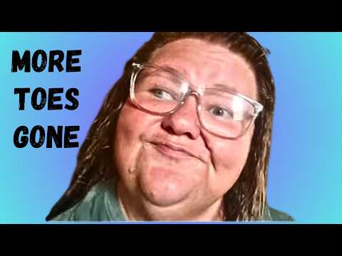 Pink Fairy Says She Had More Toe Surgery