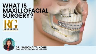 What is Oral and Maxillofacial Surgery? | DOWNLOAD THIS VIDEO IN MP3, M4A, WEBM, MP4, 3GP ETC