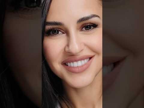 Красивая улыбка с винирами #aesthetic #veneers #bleach #стоматолог #зубы #виниры #dentist #минко