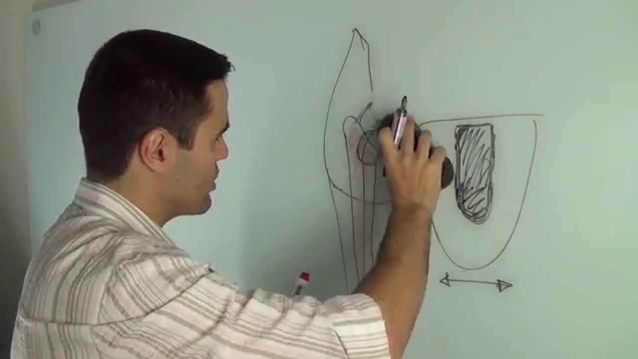 Abertura Coronária e Resistência à Fratura - Qual a Relação?