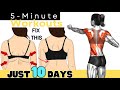 How to Lose BACK FAT and BRA BULGE ✔ Lose BACK FAT in 10 Days