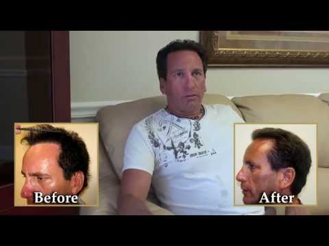 David's Testimonial