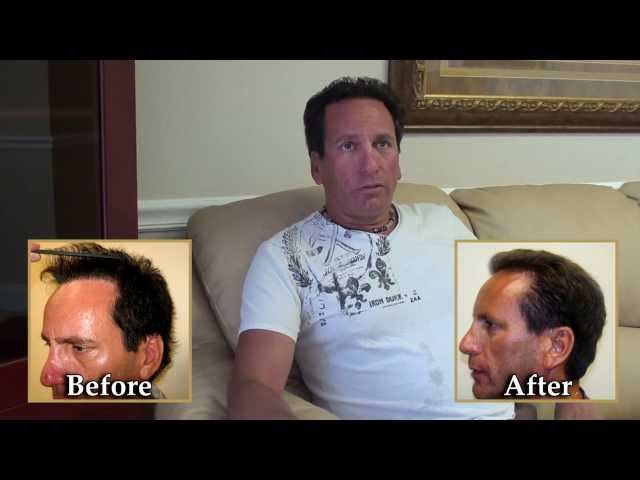 David's Testimonial