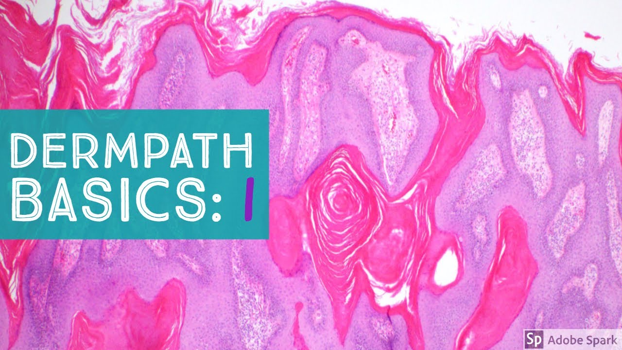 Basic Dermpath Cases  - Explained by a Dermatopathologist