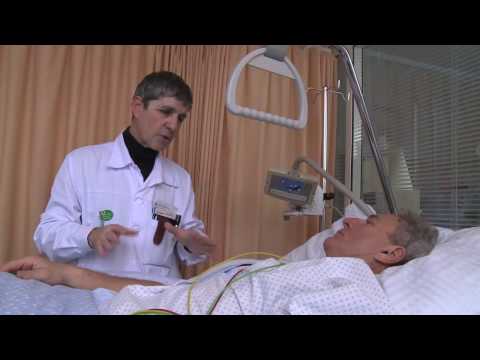 Cerebrovascular Accident (Stroke)