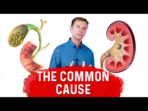 The Top SUPERFOODS for the Kidneys—Explained by Dr Berg