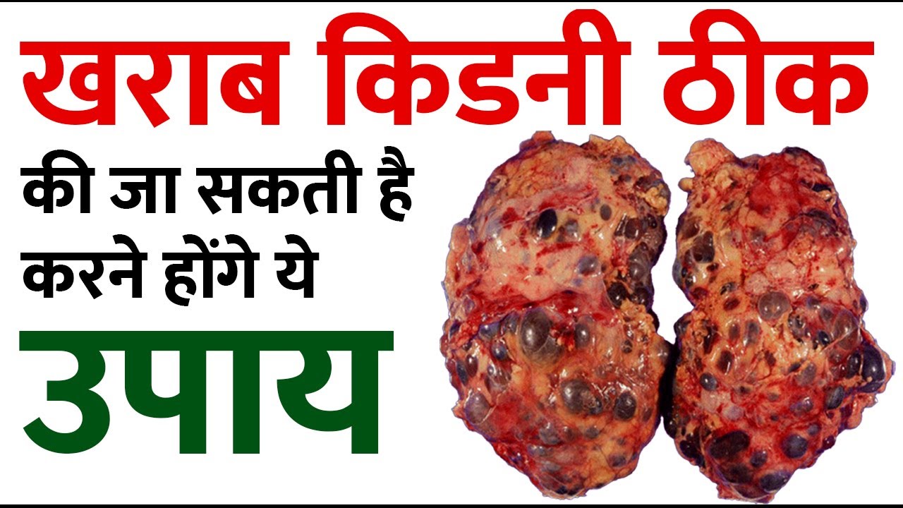 Patient video thumbnail