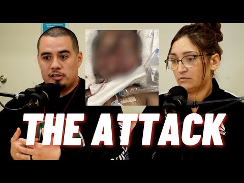 The Day Of The Pit Bulls Attack