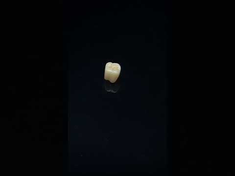 YouTube 썸네일