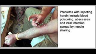 What about Heroin !? What Does it Look like or what are the Signs of Drug Abuse.-Look and Learn