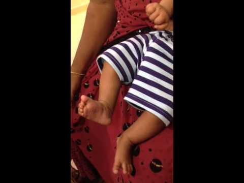 2 Month Old Infant With Jerky Movements in legs and limb. Possible differential diagnosis?