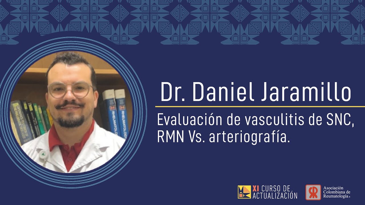 Evaluación de vasculitis de SNC, RHN Vs arteriografía  Dr.  Daniel Jaramillo