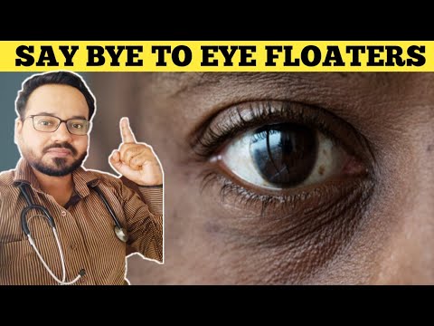How to get rid of Eye Floaters Naturally