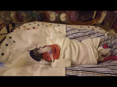 Premature Baby smiles 29 weeks old  nicu