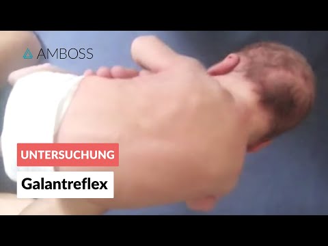 Galantreflex - Frühkindliche Reflexe - AMBOSS Video