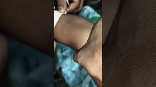 pharma.. motivated.. video.. part 1087 #shorts #viral #hospital #trending #cannula