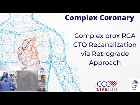 Complex prox RCA CTO Recanalization via Retrograde Approach