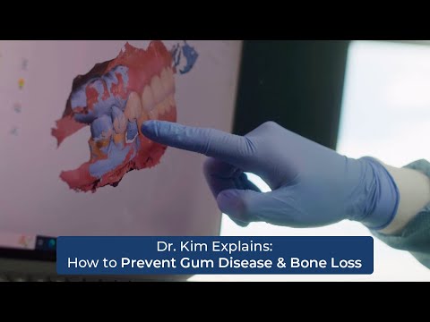 Dr. Kim Explains: How to Prevent Gum Disease & Bone Loss