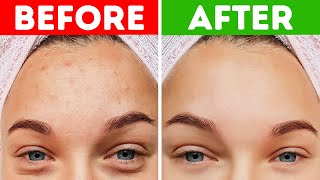 9 Reasons to Stop Taking Hot Showers