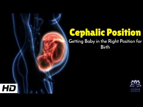 Cephalic Position: Understanding Baby’s Ideal Birth Position