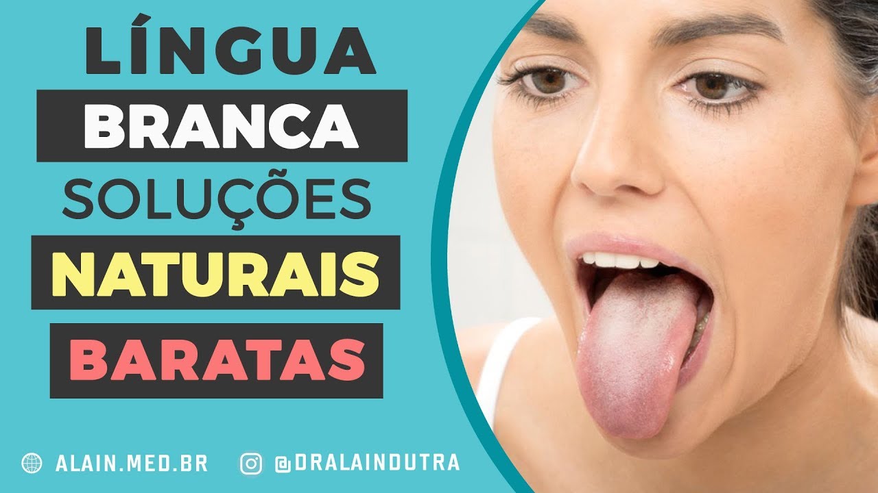 Língua branca o que pode ser e como resolver