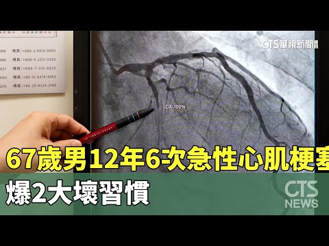67歲男12年6次急性心肌梗塞　爆2大壞習慣