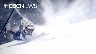 U.S. skier Lindsey Vonn has surgery on broken leg after horrific downhill crash