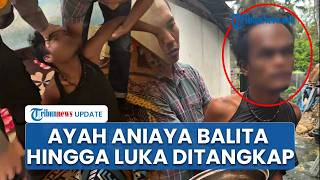 Ayah di Padang Aniaya Balita hingga Terluka Ditangkap, Korban Dipukuli hingga Disiram Air Panas
