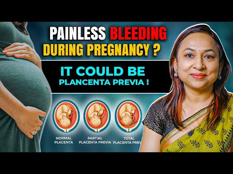 Placenta Previa EXPLAINED: Low Lying Placenta | Why Painless Bleeding Can Be Dangerous?