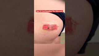 Hot vs Cold Branding: Which Heals Worse? #shorts #funny #science