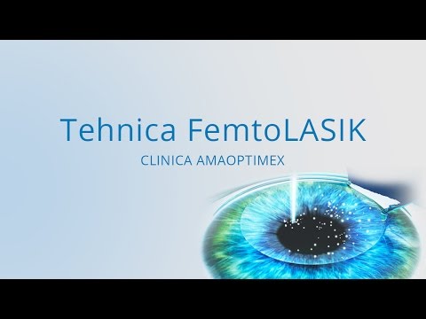 Tratamentul vederii în Khanty-Mansiysk