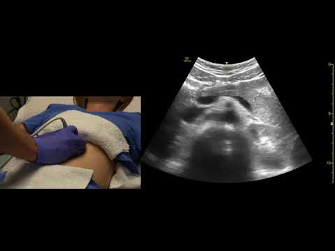 Bauchspeicheldrüse, Scanning-Technik