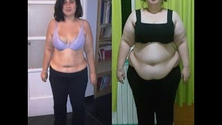 Prima/Dopo 1 anno Dall'intervento,pelle flaccida e gioia immensa!