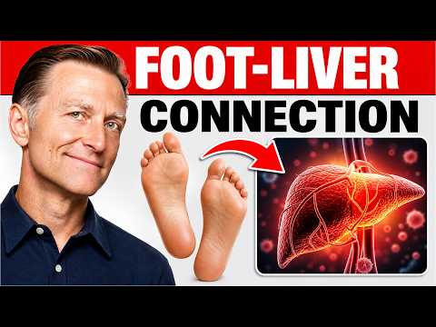 How Your Feet Are Warning You About Your Liver Problems - Dr. Berg Explains