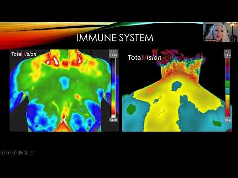 An introduction to Medical Thermography