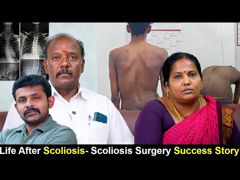Life After Scoliosis Surgery - patient testimonial