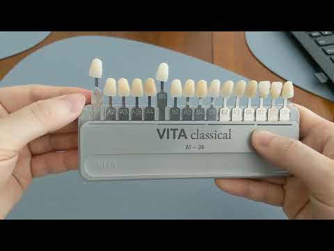 A1 vs B1 Tooth Color