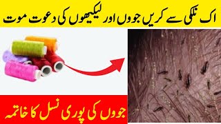 useful kitchen tips | Amazing time money Saving Tips |get rid of lices In very easy way 🙄