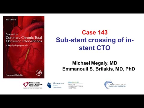 Case 143: Manual of CTO PCI - Sub stent crossing