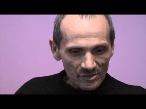 Ion Băloi are nevoie de un fololiu rulant electric