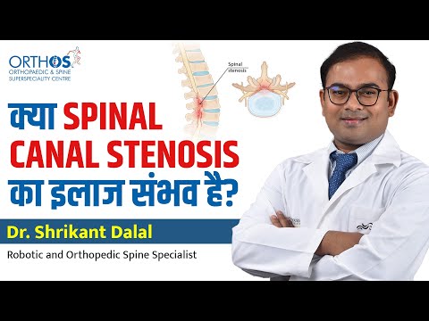 Is Spinal Canal Stenosis Treatable? | Dr. Shrikant Dalal