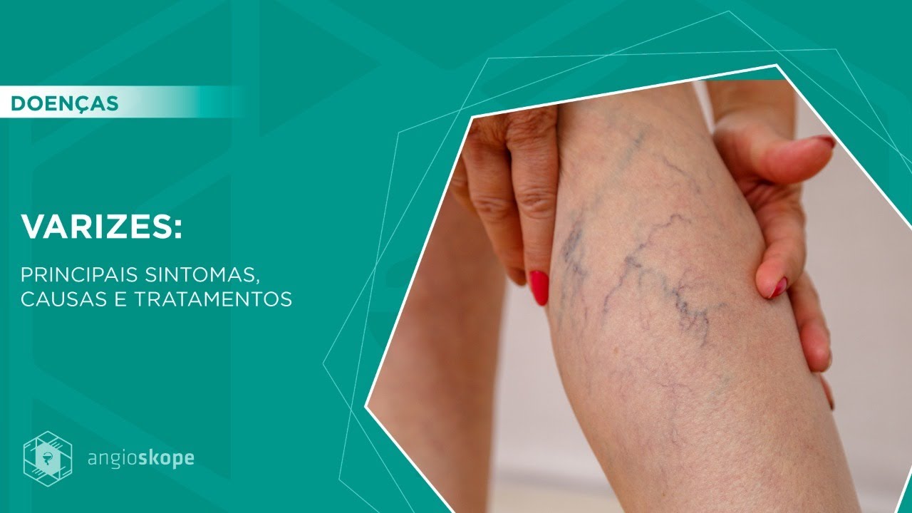 Euvaldo Jaqueto Junior-19